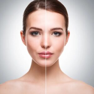 Dermaheal SB