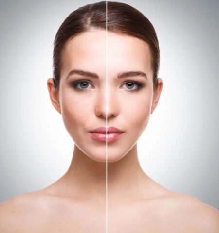 Dermaheal SB